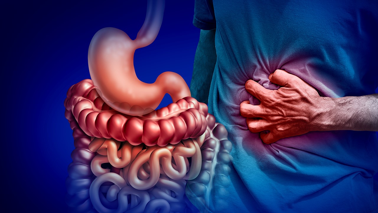 Se puede trabajar con la enfermedad de crohn